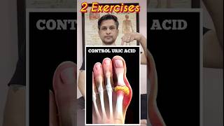 2 Best Exercises for Control URIC ACID shorts [upl. by Goeselt]