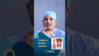 How Is Colon Cancer Treated  Insights from Dr Nilesh chordiya SSO [upl. by Ynots929]