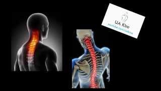 Dolor Cervical y Cervicobraquialgia  Semiologia [upl. by Cesar632]