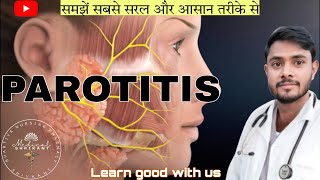 Parotitis  parotitis in hindi  paroted gland swelling  paroted gland or salivary gland infection [upl. by Katzen]