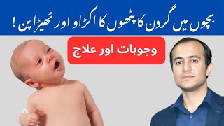 Torticollis in Babies Causes Symptoms and Treatment Options Explained  urdu amp hindi [upl. by Neerhtak749]