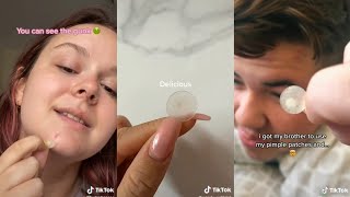 TRYING PIMPLE PATCH TIKTOK COMPILATION [upl. by Suter]