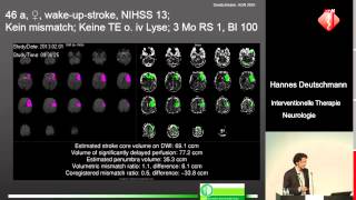 Interventionelle Therapie bei akuter neurologischer Symptomatik  Hannes Deutschmann [upl. by Mond182]