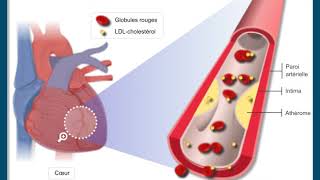 Questce que lathérosclérose [upl. by Coryden]