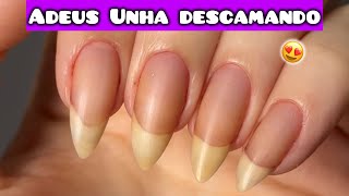 UNHAS DESCAMANDO O QUE FAZER SOLUÇÕES COMPLETAS [upl. by Asseram]