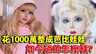 花1000萬整容成真人芭比娃娃，如今卻生活不能自理！ 整容 明星觀察員 [upl. by Seravart]