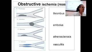 About Abnomality of periferal blood flow in 3 min Professor Maksimovich N Ye [upl. by Missi873]