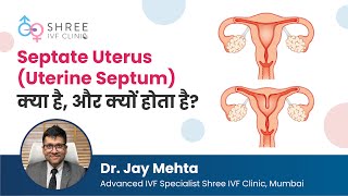 Septate Uterus Uterine Septum क्या है और क्यों होता है  Dr Jay Mehta [upl. by Sherurd]