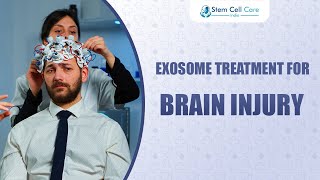 Exosome Treatment For Brain Injury  Brain Injury Treatment  Stem Cells  Neurological Disease [upl. by Onabru]