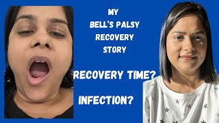 How I Recovered From Bells Palsy  Facial Paralysis [upl. by Chelsey252]