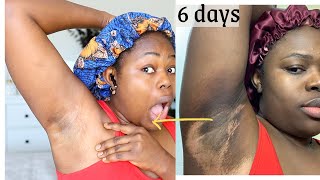 Home made Super fast under arm Lightening Scrub I AM STILL SHOCKED [upl. by Novak]