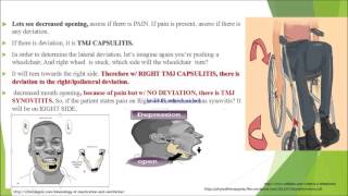 TMJ Deviation summary [upl. by Wallache]