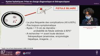 Kystes hydatiques  Prise en charge diagnostique et thérapeutique  S Bresson Hadni [upl. by Corwin]