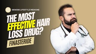 Is Finasteride The MOST Effective Hair Loss Medication [upl. by Arriaes]