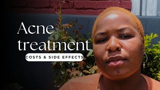 Oratane Acne Treatment  Costs  Side effects [upl. by Otnas]