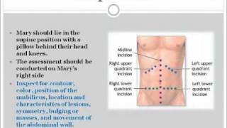 abdominal assessment NURSING FALL 2010 [upl. by Aglo]