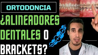 Ventajas y desventajas de ALINEADORES TRANSPARENTES y ORTODONCIA con BRACKETS [upl. by Nyllij857]