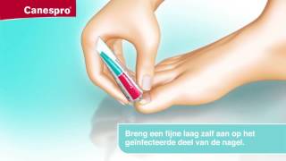 Canespro Behandeling Voor Schimmelnagels  TV Reclame [upl. by Garret]