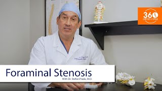 Foraminal Stenosis  360 Ortho amp Spine [upl. by Aniroc]