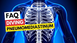 FAQ Diving amp Pneumomediastinum [upl. by Ahtaga]