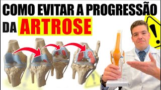 Aula 3 Como evitar a progressão da Artrose [upl. by Ettevets]