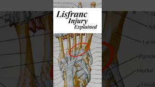 🚨 Understanding DeMarcus Lawrences Lisfranc Injury✨ [upl. by Orfinger714]