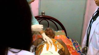 Nasogastric Tube Insertion to a Stroke Patient [upl. by Utica]