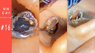 GOLDEN Shiny amp Super DIRTY Earwax EP16  NN Ear cleaning [upl. by Aicylla]