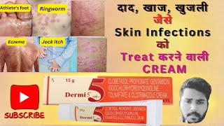 DERMI 5 Cream  Effective Solution for Skin Infections  Dermi 5 Cream Uses And Benefits [upl. by Kristie]