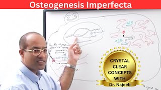 Osteogenesis Imperfecta amp Its Types  Pathology [upl. by Germaun]