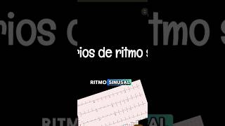 Criterios de un ritmo sinusal✅💯 ecg cardiologia medicina [upl. by Aiken]