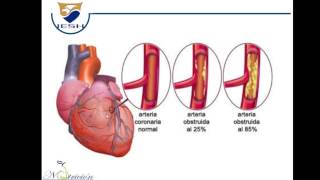 Anticoagulantes y antiagregantes plaquetarios [upl. by Ayela]