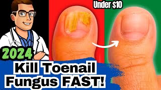 1 NEW Best Toenail Fungus Treatments Medications vs Creams vs Laser [upl. by Ellerey]