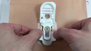 Gastrostomy Button Securement Device [upl. by Chirlin]