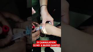 IV CANNULATION amp BLOOD SAMPLE youtubeshorts medical clinic shorts cannula bloodsample [upl. by Darken]