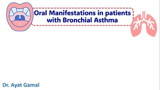 Oral manifestations of bronchial asthma amp medication modifications [upl. by Kusin]