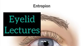 Eyelid lectures part 2 Eye lectures ophthalmology jatoi eyelectures eyelid eyedetaillecture [upl. by Autrey]