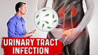 Top Natural Remedies for a UTI Urinary Tract Infection [upl. by Elaina]