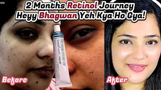 2Month RetinolTretinoin Journey My Results Challenges and Tips [upl. by Artemla178]