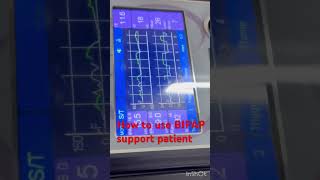 How to use bipap machine  BIPAP support icu patient  BIPAP setup icu patient  bipap shorts [upl. by Pauline]