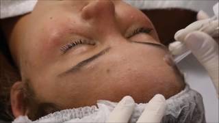 Beauty Dermo  Aparelho de Vacuoterapia e Endermoterapia [upl. by Tanhya678]