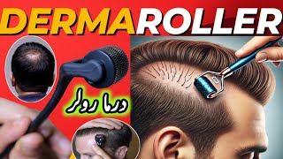 Microneedling  Derma Rolling for Hair Regrowth  Derma Roller Side Effects [upl. by Fons]