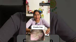 Care of the scalp head of babies [upl. by Jeramie]