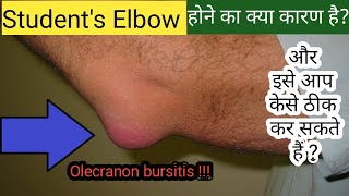 Olecranon Bursitis Elbow Bursitis  Students Elbow  Prevention Treatment Exercises amp Home Care [upl. by Allana]