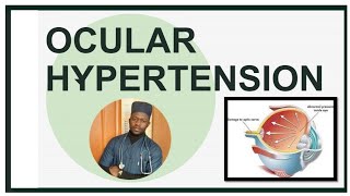 Ocular Hypertension [upl. by Gnouhc]