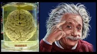 How Albert Einsteins Brain was Different [upl. by Rednasyl]