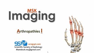 05 Joint disease arthropathy I TEC Prof Mamdouh Mahfouz [upl. by Hervey]