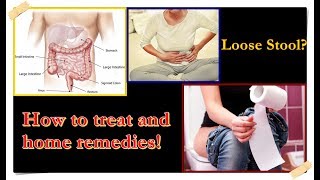 Loose Stool – Causes Treatment Home Remedies [upl. by Ettelimay]