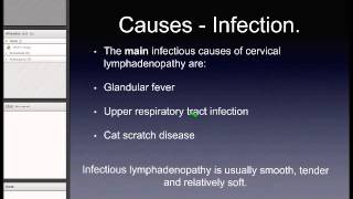 Cervical Lymphadenopathy [upl. by Samot685]