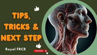 Head amp Neck Imaging  Tips Tricks and Next Step for FRCR 2a [upl. by Ibrek207]